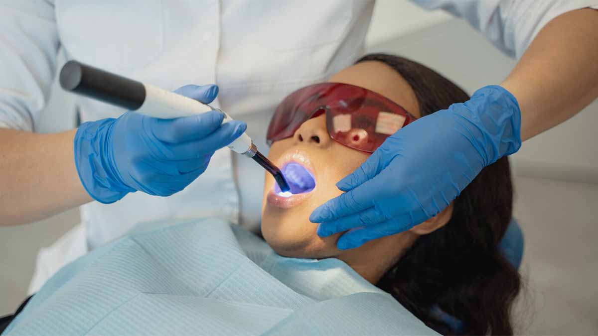 مزایای کامپوزیت دندان چیست؟